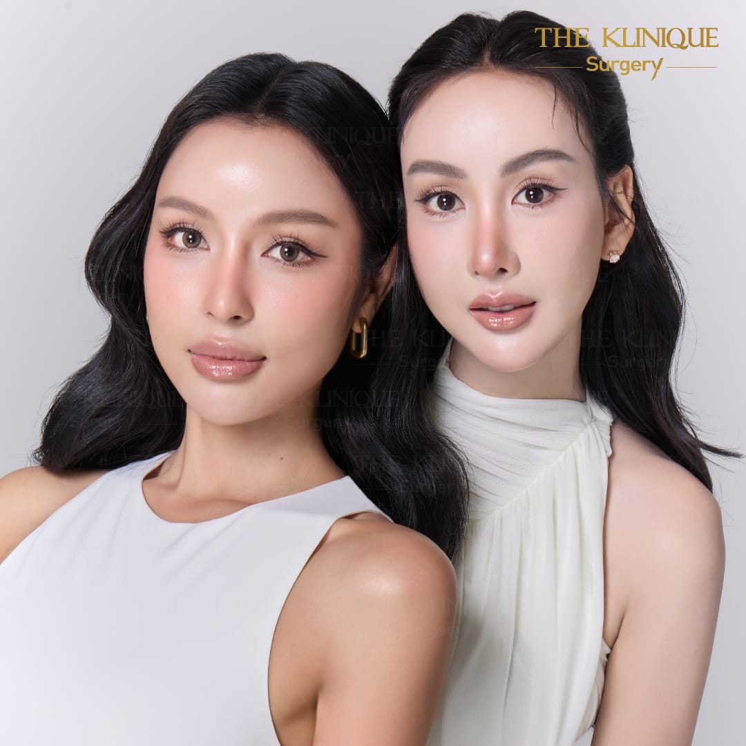 facelift review 10-year younger look before and after skin tightening procedure