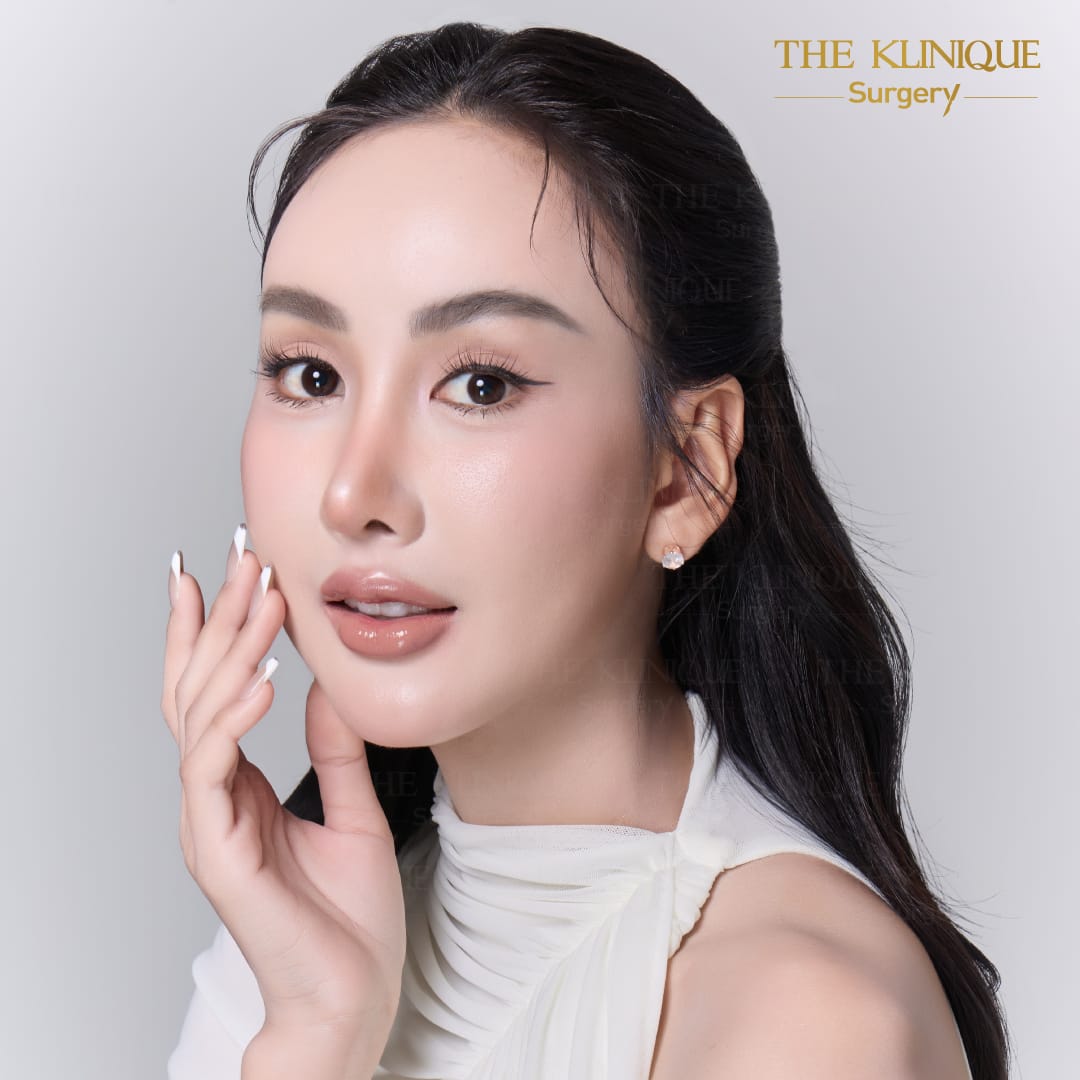 facelift review 10-year younger look before and after skin tightening procedure