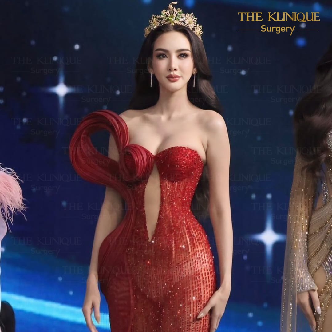 facelift review 10-year younger look before and after skin tightening procedure