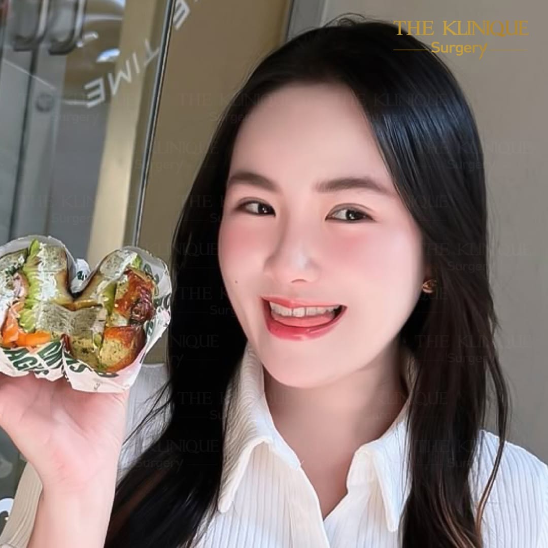 รีวิวทำตาสองชั้น แก้ไขปัญหาตาหลบใน