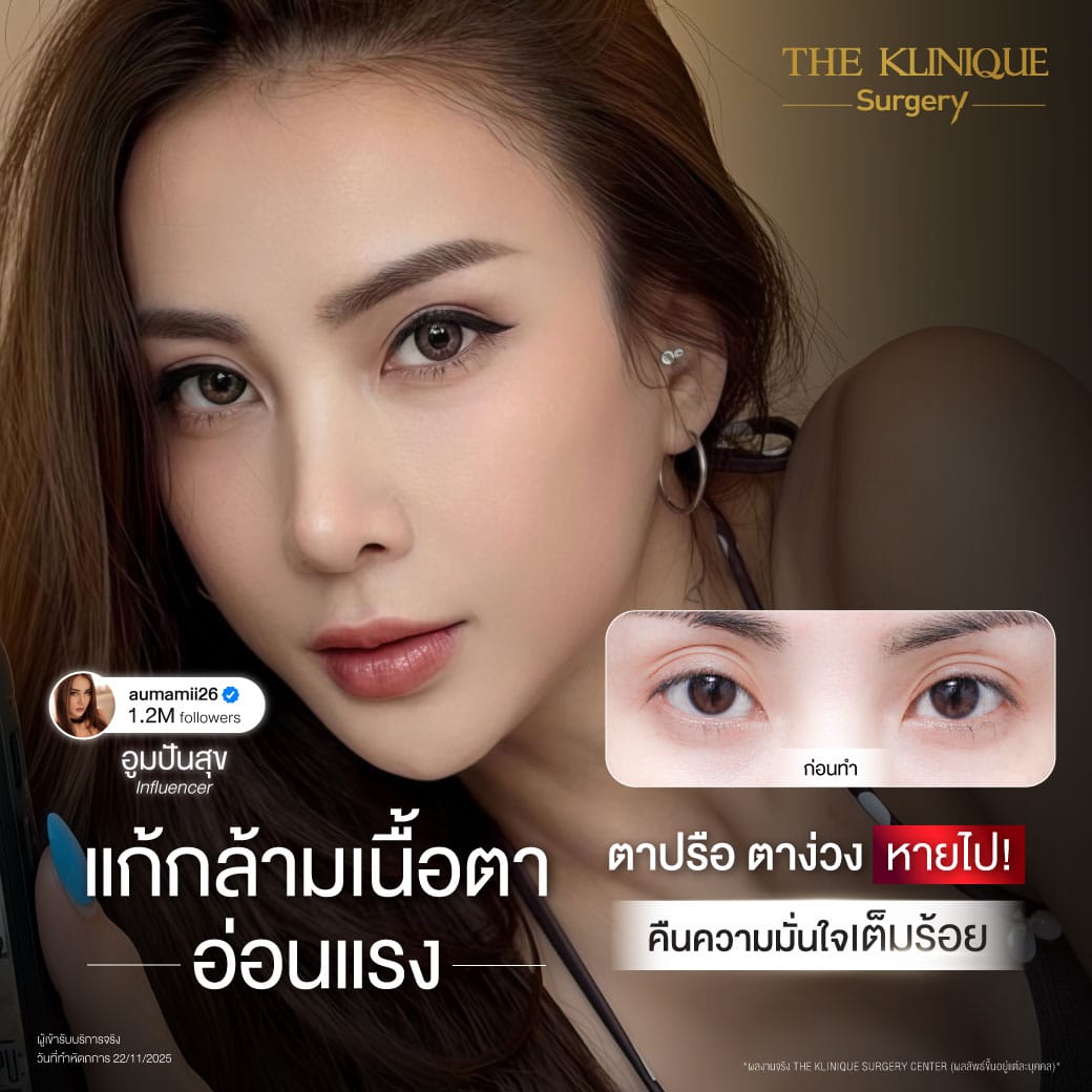 ศัลยกรรมตา, ศัลยกรรมตาสองชั้น, ศัลยกรรมตาสองชั้น ราคา, ศัลยกรรมตาที่ไหนดี, ศัลยกรรมตามีกี่แบบ, ตาสองชั้น, ตาสองชั้นหลบใน, คลินิกทำตา, ตาสองชั้นที่ไหนดี, ตาสองชั้นแบบกรีดสั้น กรีดยาว, กล้ามเนื้อตาอ่อนแรง, แก้ตา, แก้ตาสองชั้น, แก้หนังตาตก, แก้ชั้นตาใหญ่, แก้ตาไม่เท่ากัน, หนังตาตก, แก้หนังตาตก,Ophthalmologis,จักษุศัลยแพทย์,คลินิกทำตาสองชั้น ใจกลางสยามสแคว์ , แก้ตาอ่อนแรง ใจกลางสยาม,ตาง่วง, ตาปรือ, ทำตาสองชั้นที่ไหนดี, แพทย์ Oculoplastic, มัดกล้ามเนื้อตา, รีวิวแก้กล้ามเนื้อตาอ่อนแรง, แก้ไขกล้ามเนื้อตาอ่อนแรง