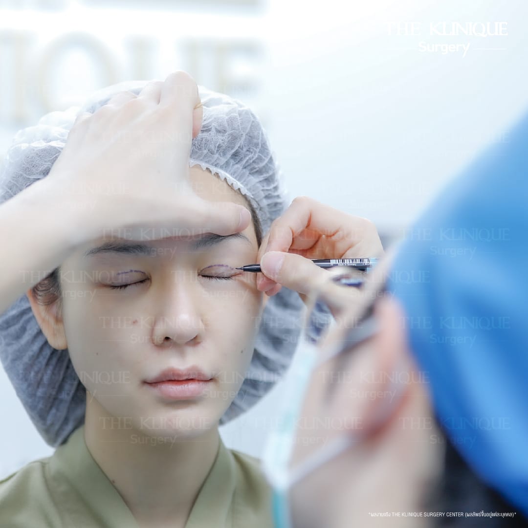 Expert Ophthalmologist Dr. Son analyzing eyelid muscle function for revision surgery