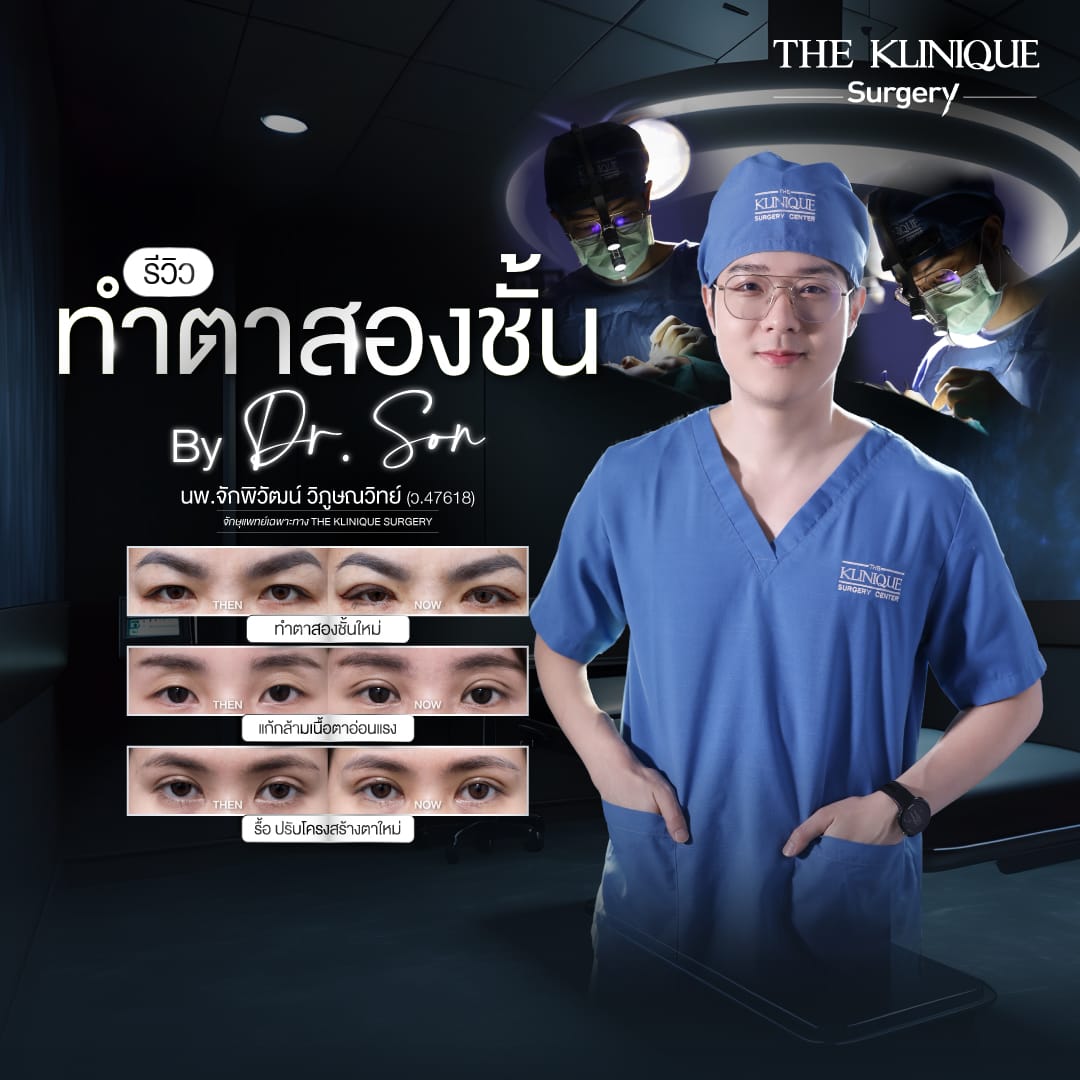 Double Eyelid Surgery