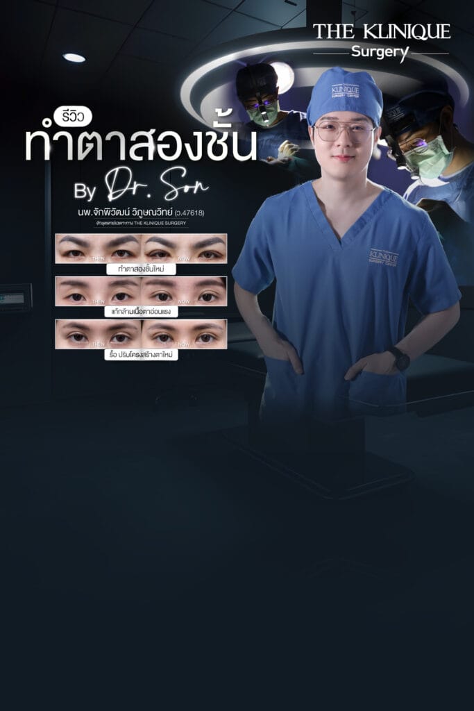 Double Eyelid Surgery