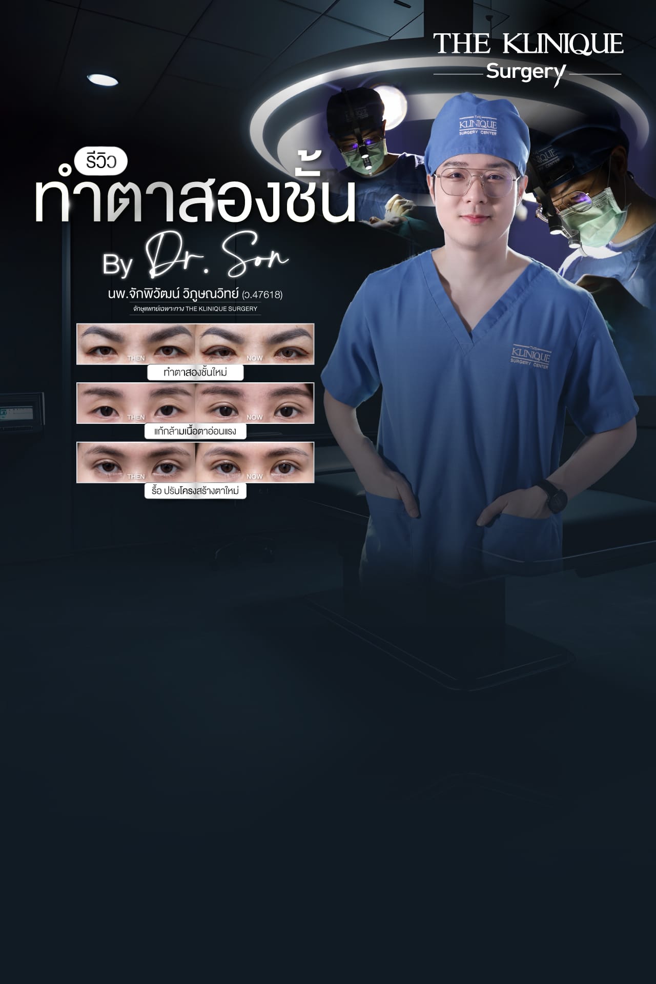 Double Eyelid Surgery