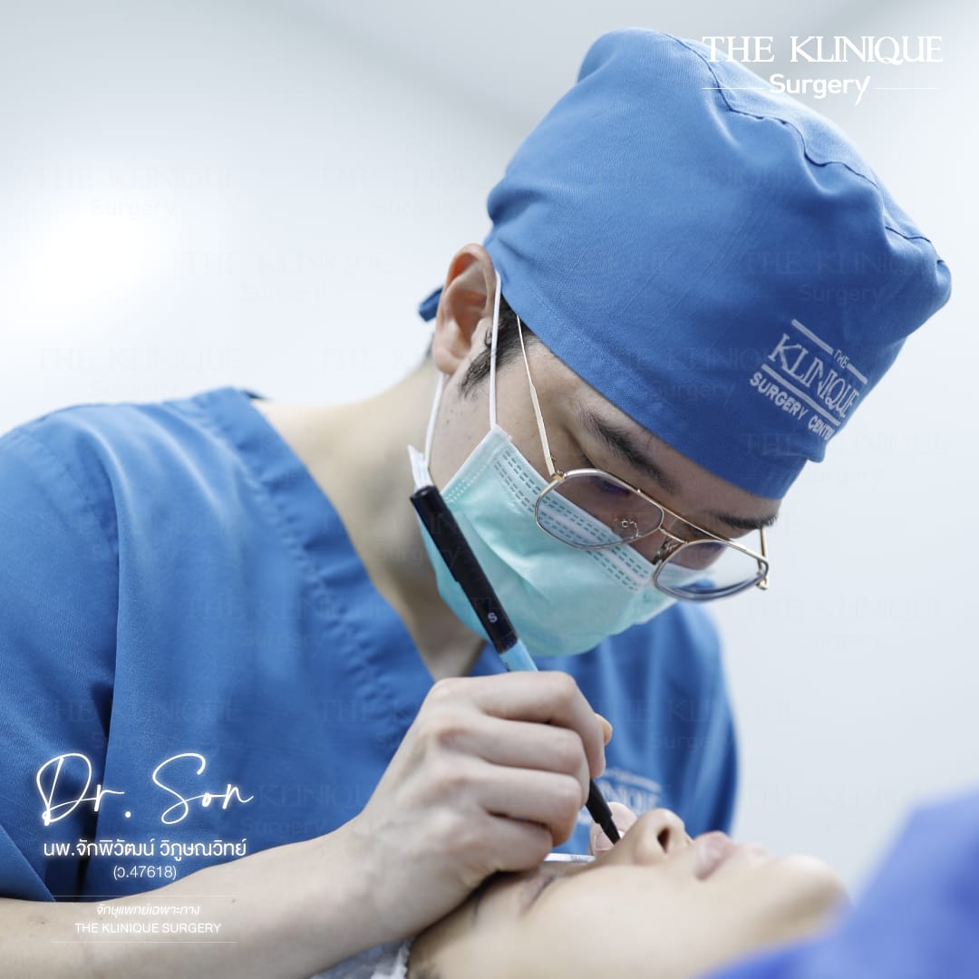 Double Eyelid Surgery