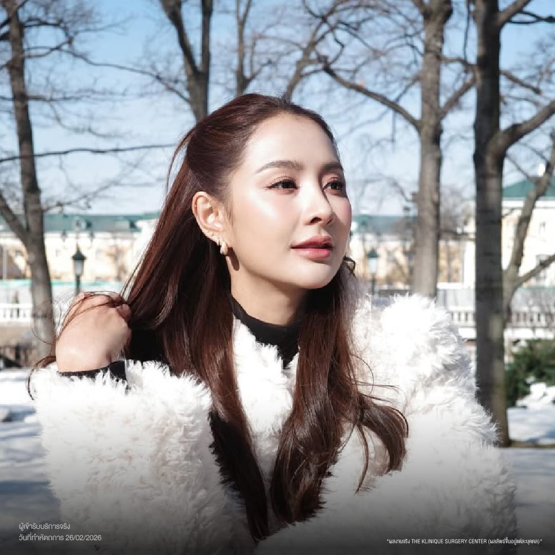 ศัลยกรรมจมูก, ศัลยกรรมจมูก รีวิว, เสริมจมูก, รีวิวเสริมจมูก, ทำจมูก, ทำจมูก รีวิว, ทำจมูก แบบ Open, ซิลิโคนจมูก, จมูก Open, เสริมจมูกโอเพ่น, เสริมจมูกOpen ที่ไหนดี, เสริมจมูกโอเพ่น ที่ไหนดี, เสริมจมูกโอเพ่น Open คือ, รีวิวเสริมจมูกโอเพ่น Open, ทรงจมูก, ทรงจมูกสวย, ทรงจมูกธรรมชาติ, ทรงจมูกสโลปปลายพุ่ง, ศัลยกรรมจมูกทีไ่หนดี, ศัลยกรรมจมูกมีกี่แบบ, เสริมจมูกที่ไหนดี, เสริมจมูกโอเพ่น, เสริมจมูกOpen, ทำจมูกรีวิว, ซิลิโคนจมูก,แก้จมูก, แก้จมูกที่ไหนดี, ทรงจมูกผู้ชาย, เสริมจมูกผู้ชาย, ศัลยฯจมูก, ถอดซิลิโคนจมูก, จมูก Semi Open