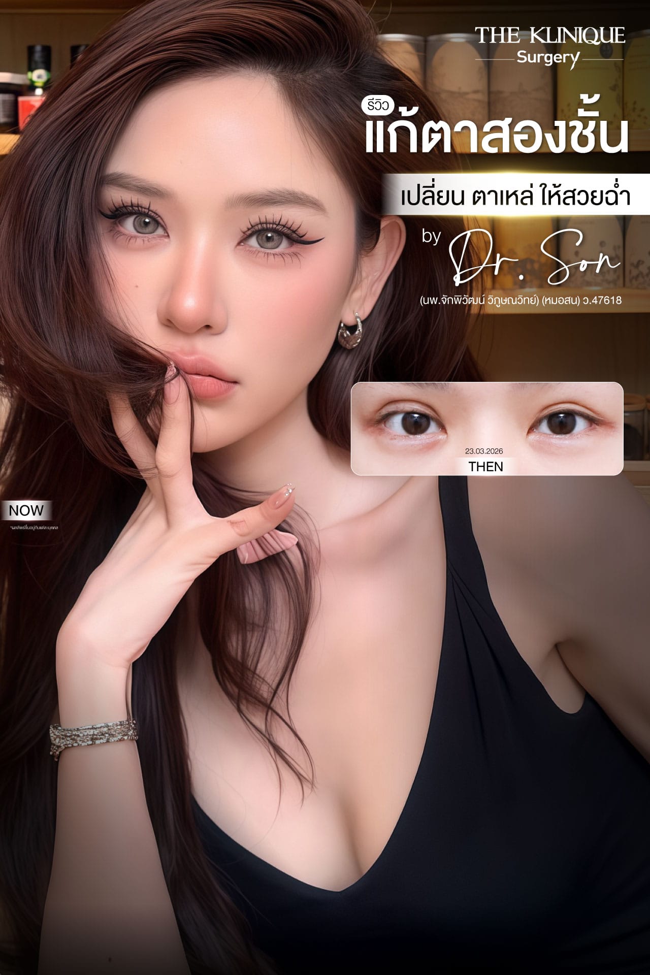 "Before and after revision double eyelid surgery by Dr. Son at THE KLINIQUE