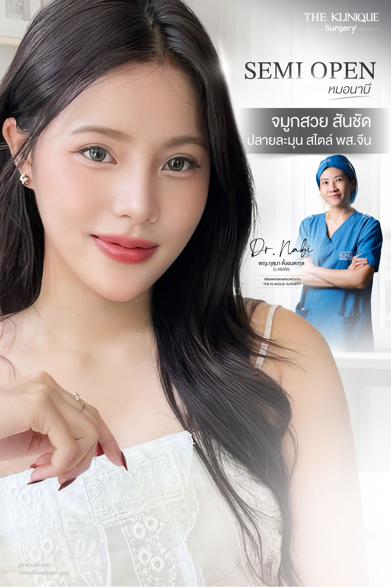รีวิว เสริมจมูก semi open สไตล์ พส. จีน
