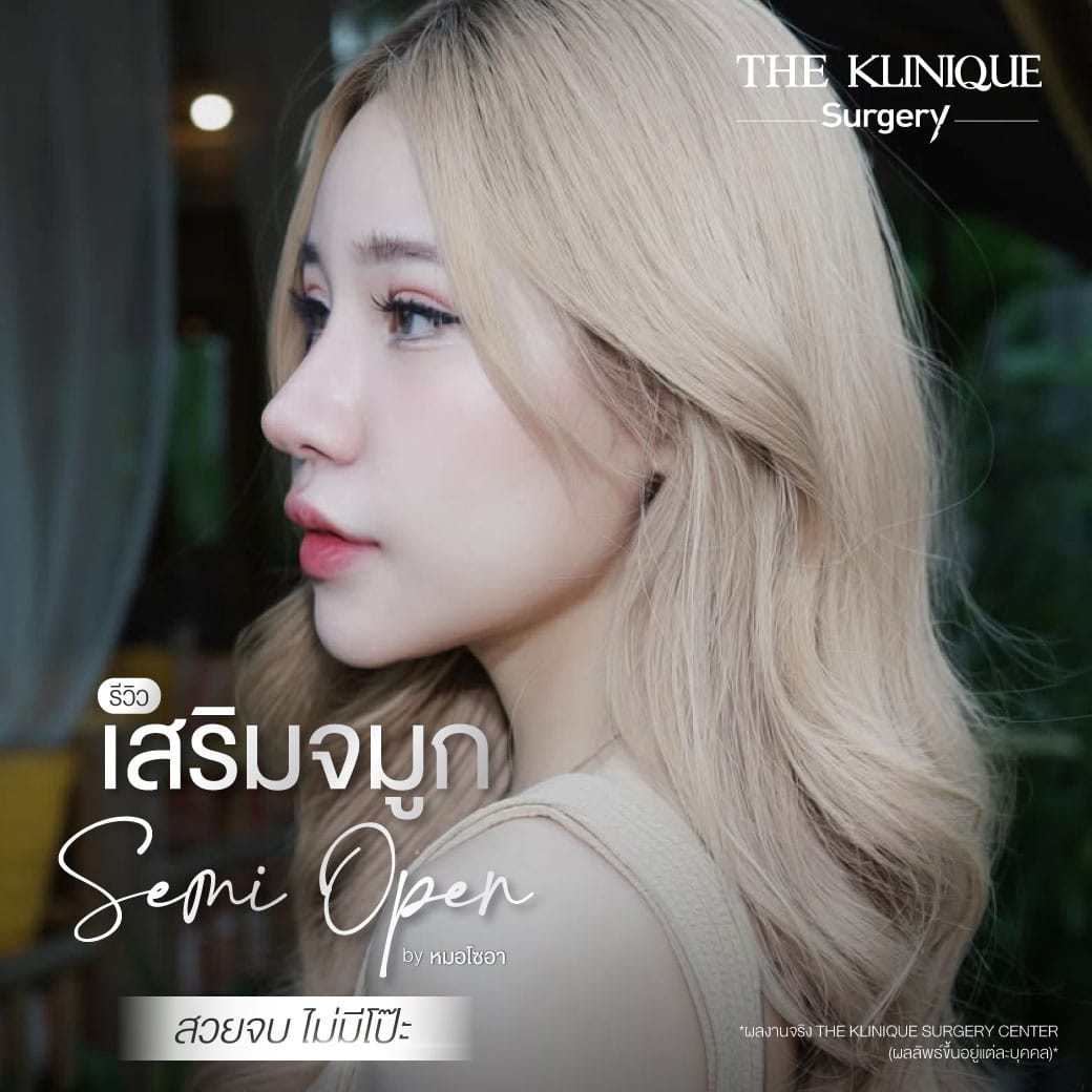 เคสแก้จมูกพังเป็นงานปังด้วยเทคนิค เสริมจมูก Semi Open โดยคุณหมอโซอา The Klinique Surgery