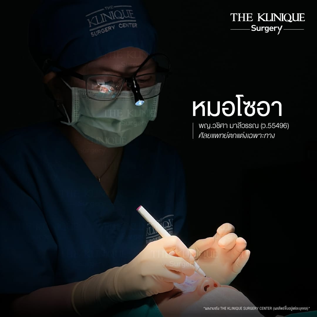 เคสแก้จมูกพังเป็นงานปังด้วยเทคนิค เสริมจมูก Semi Open โดยคุณหมอโซอา The Klinique Surgery