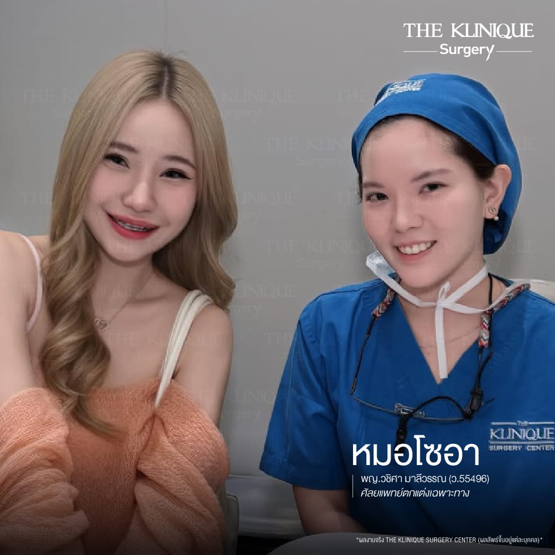 เคสแก้จมูกพังเป็นงานปังด้วยเทคนิค เสริมจมูก Semi Open โดยคุณหมอโซอา The Klinique Surgery