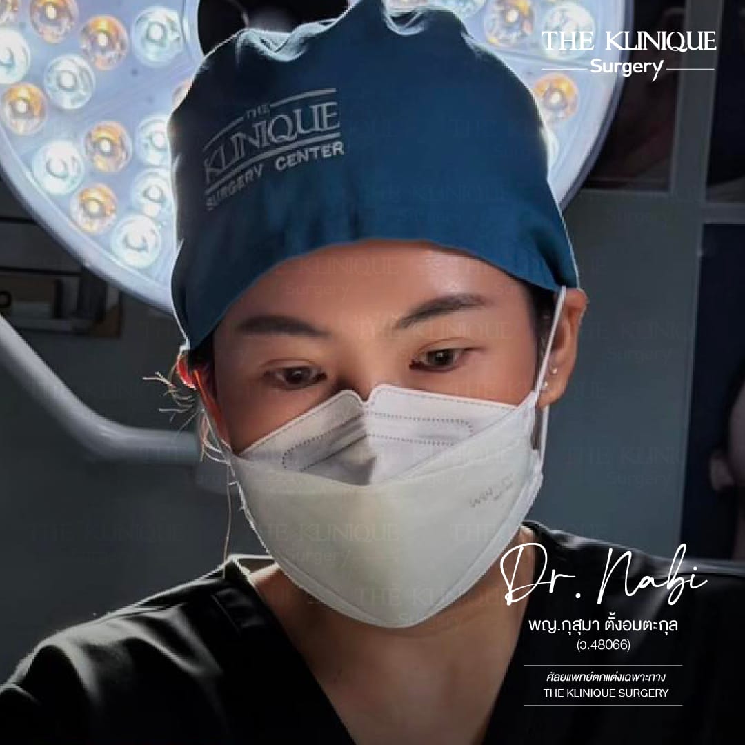 รีวิว เสริมจมูก semi open สไตล์ พส. จีน