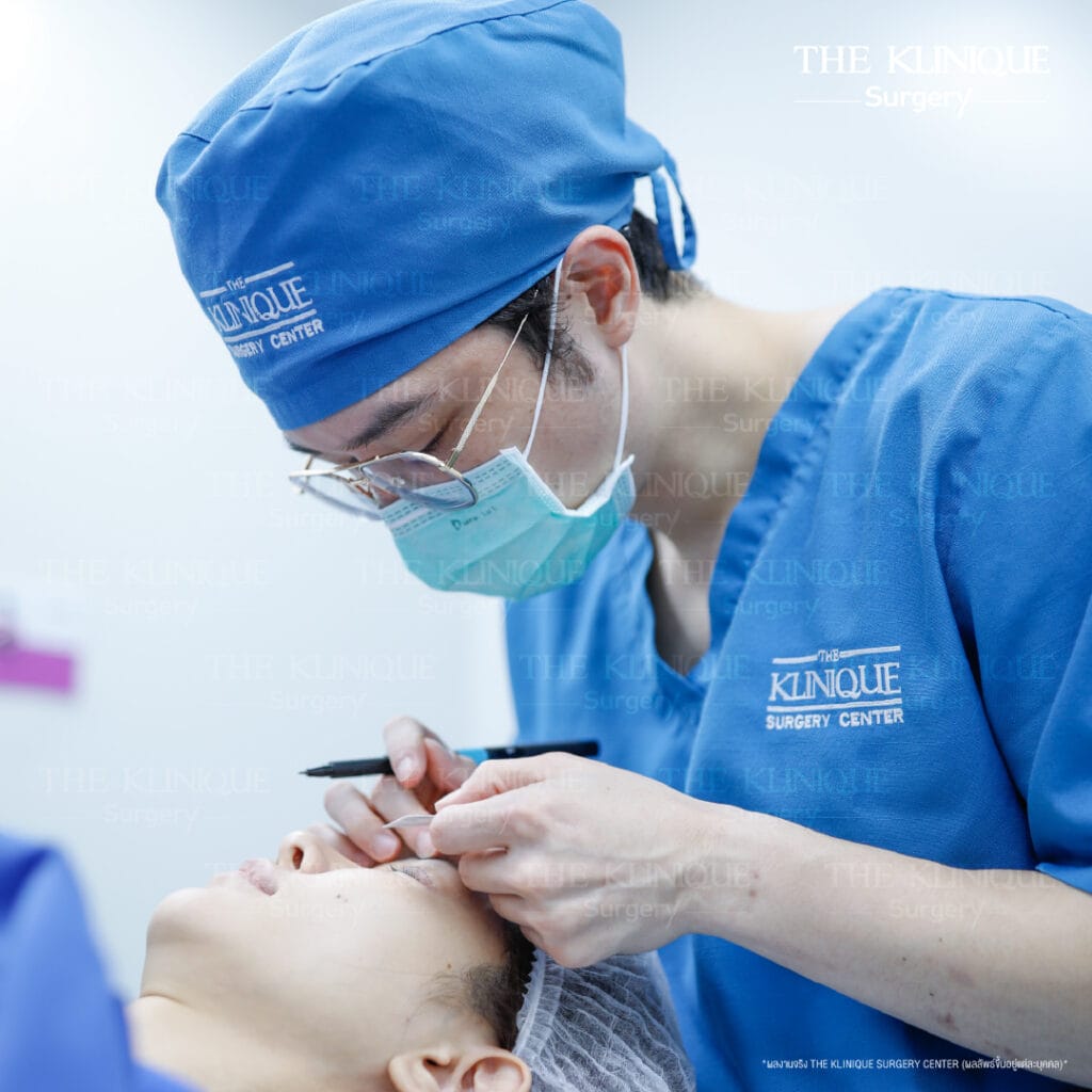 "Before and after revision double eyelid surgery by Dr. Son at THE KLINIQUE
