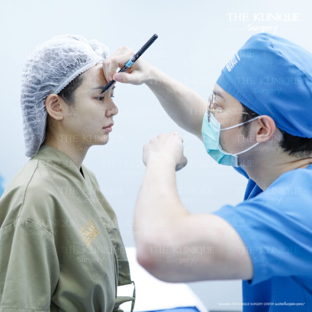 "Before and after revision double eyelid surgery by Dr. Son at THE KLINIQUE