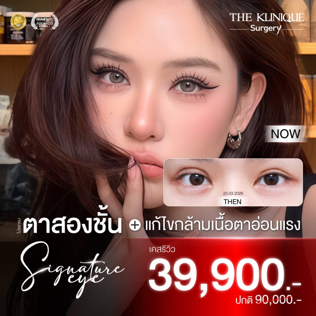 "Before and after revision double eyelid surgery by Dr. Son at THE KLINIQUE