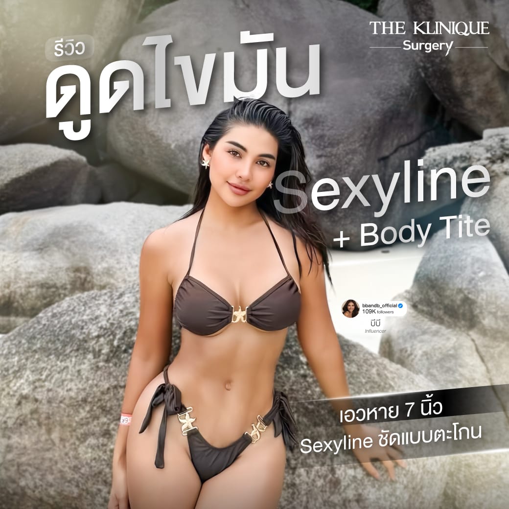 รีวิวดูดไขมันสร้าง Sexy Line ร่อง 11 และกระชับผิว BodyTite เคสคุณบีบี นิธิพร อัปเดต 1 ปี