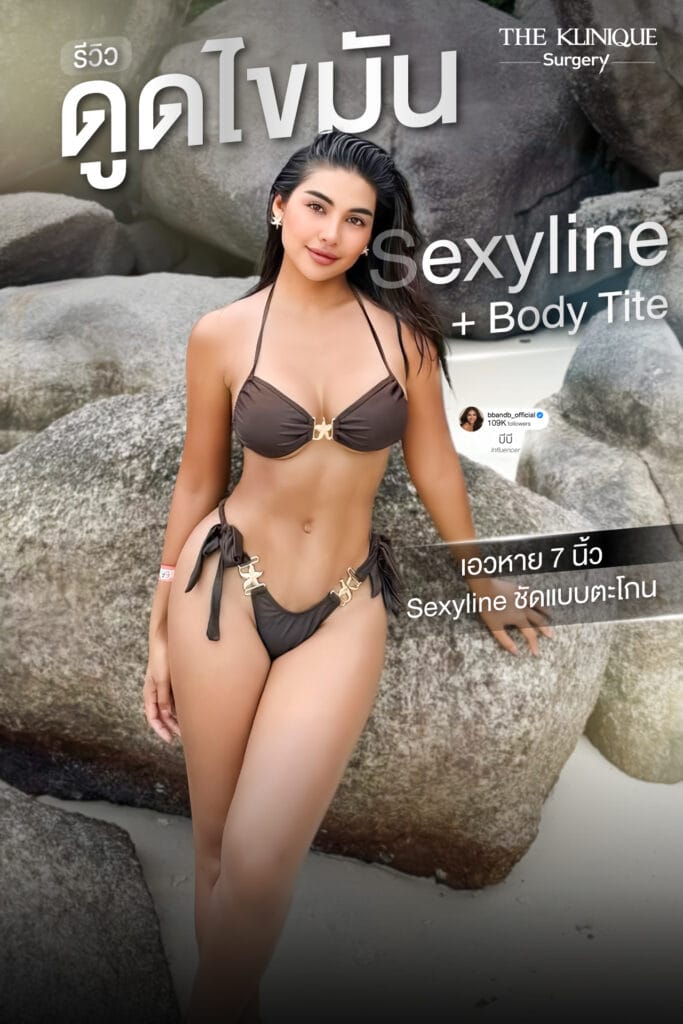 รีวิวดูดไขมันสร้าง Sexy Line ร่อง 11 และกระชับผิว BodyTite เคสคุณบีบี นิธิพร อัปเดต 1 ปี