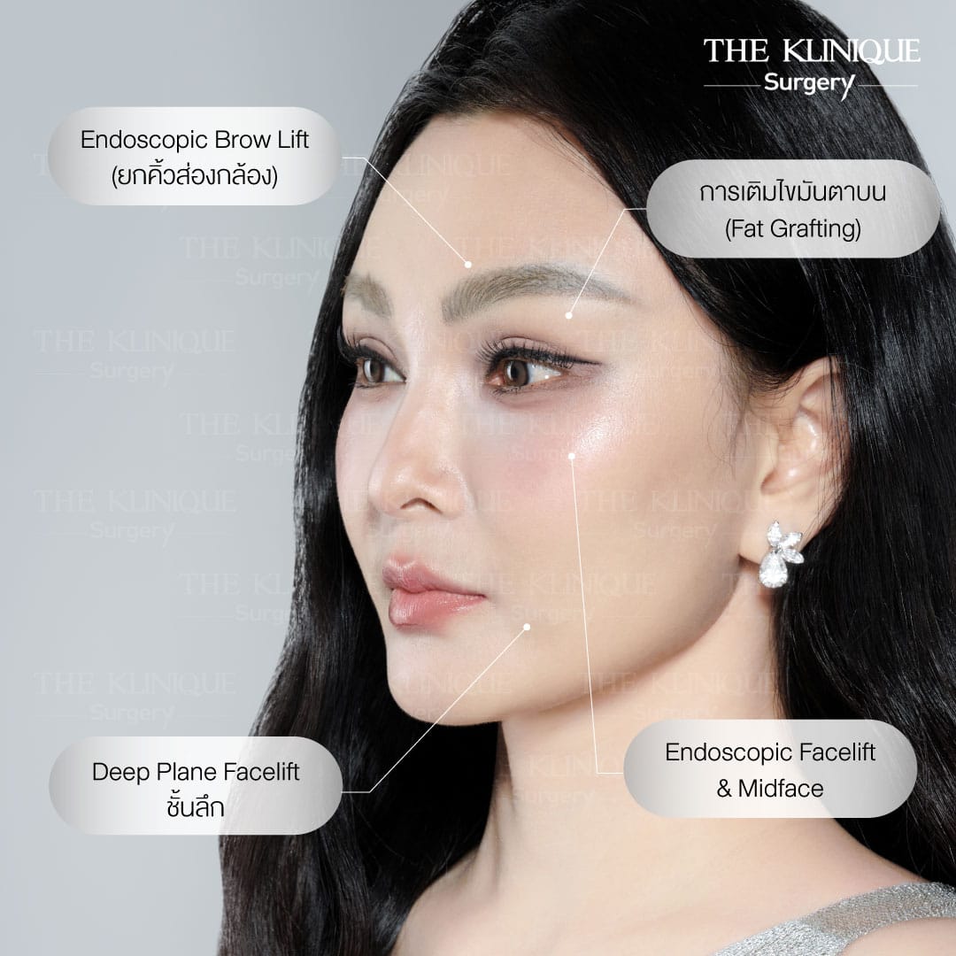 ดึงหน้า Facelift ย้อนวัยหน้าเด็กของคุณแคนดี้ รากแก่น