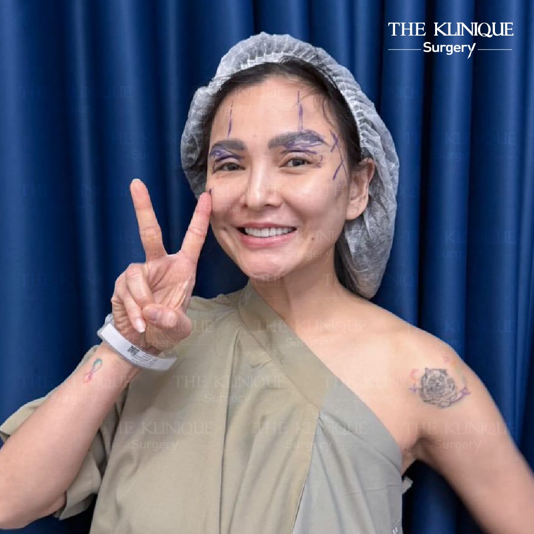 ดึงหน้า Facelift ย้อนวัยหน้าเด็กของคุณแคนดี้ รากแก่น