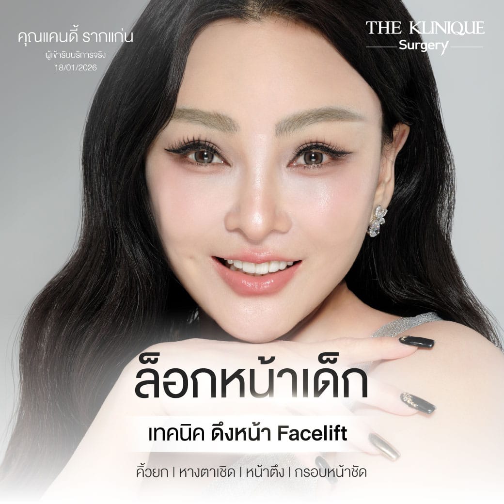 รีวิว ดึงหน้า Facelift