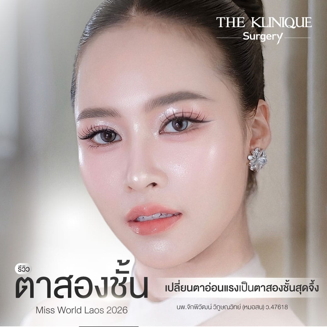 รีวิว ตาสองชั้น Miss World Laos 2026