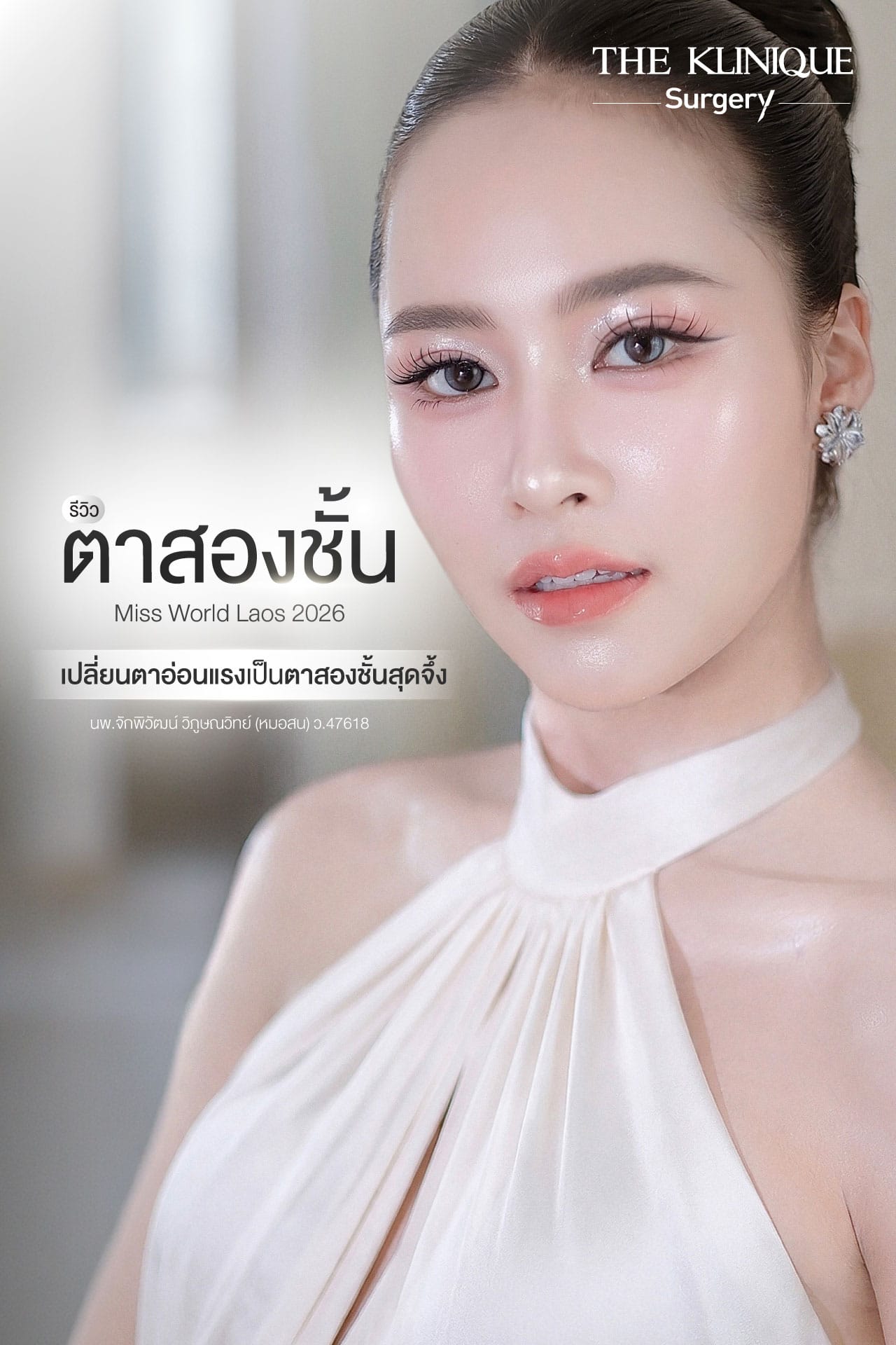 รีวิว ตาสองชั้น Miss World Laos 2026
