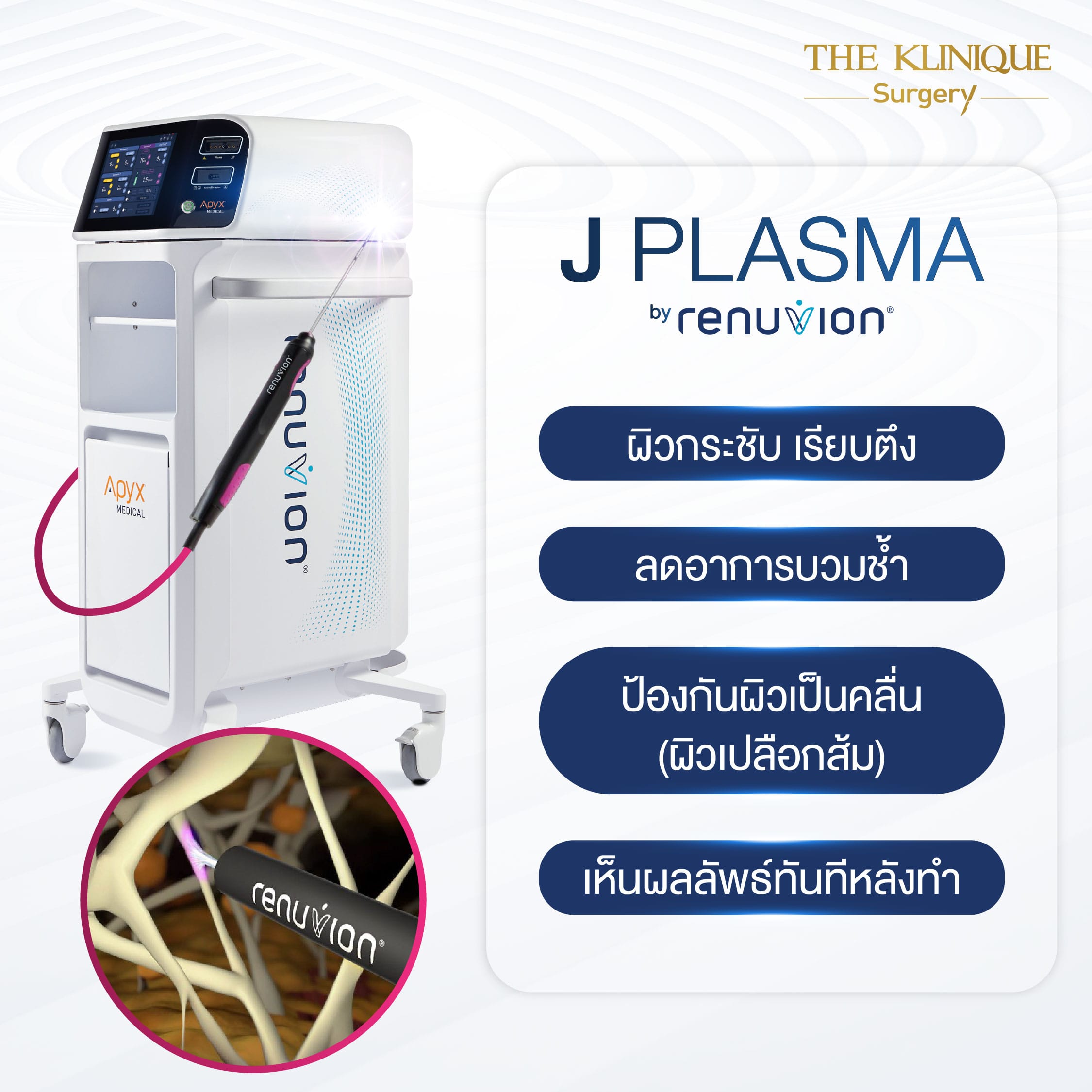 ยกกระชับผิวด้วย J Plasma