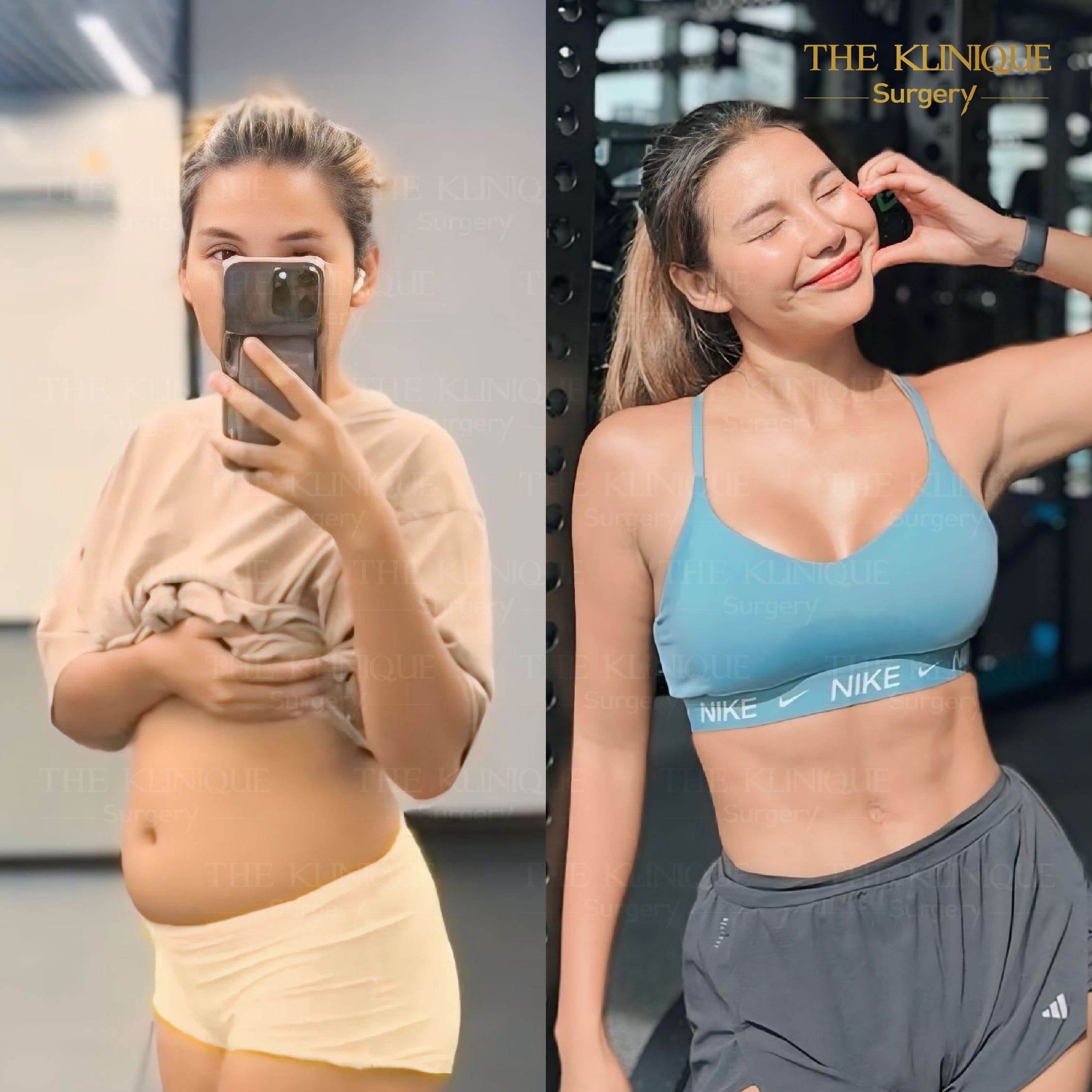 before-after-lipo