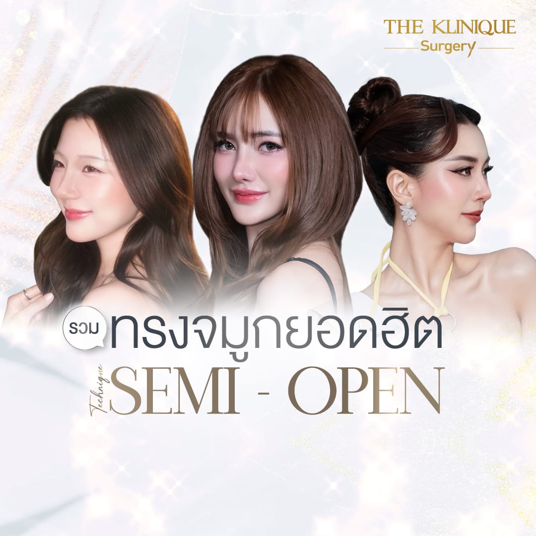 รีวิว เสริมจมูก semi open สไตล์ พส. จีน ปลายเชิดหยดน้ำ ลุคเน็ตไอดอลจีน