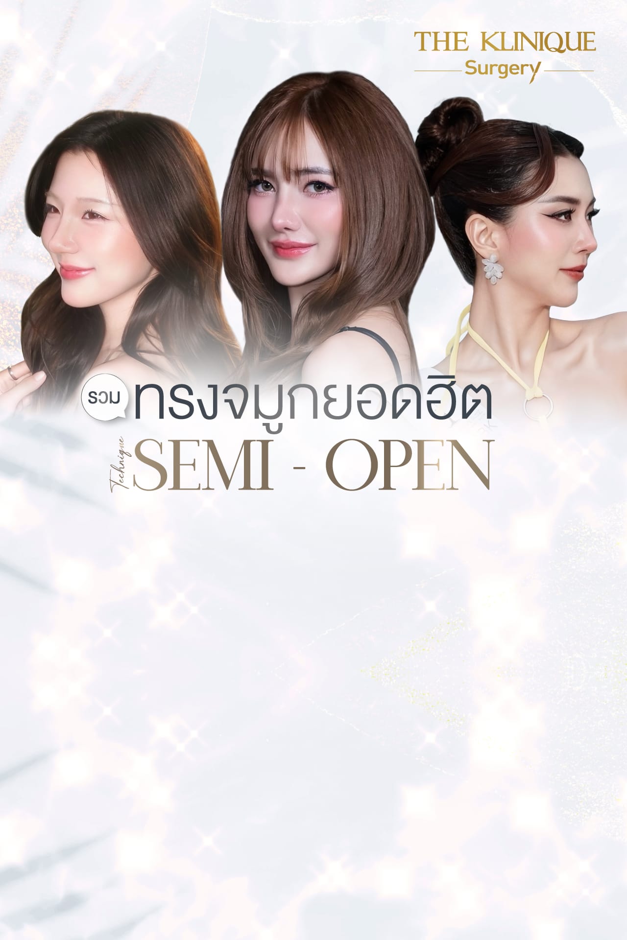 รีวิว เสริมจมูก semi open สไตล์ พส. จีน ปลายเชิดหยดน้ำ ลุคเน็ตไอดอลจีน