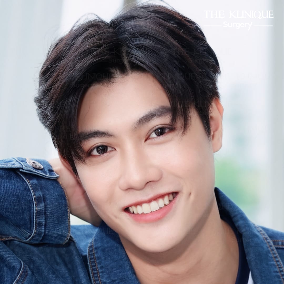 รีวิวทำตาสองชั้น