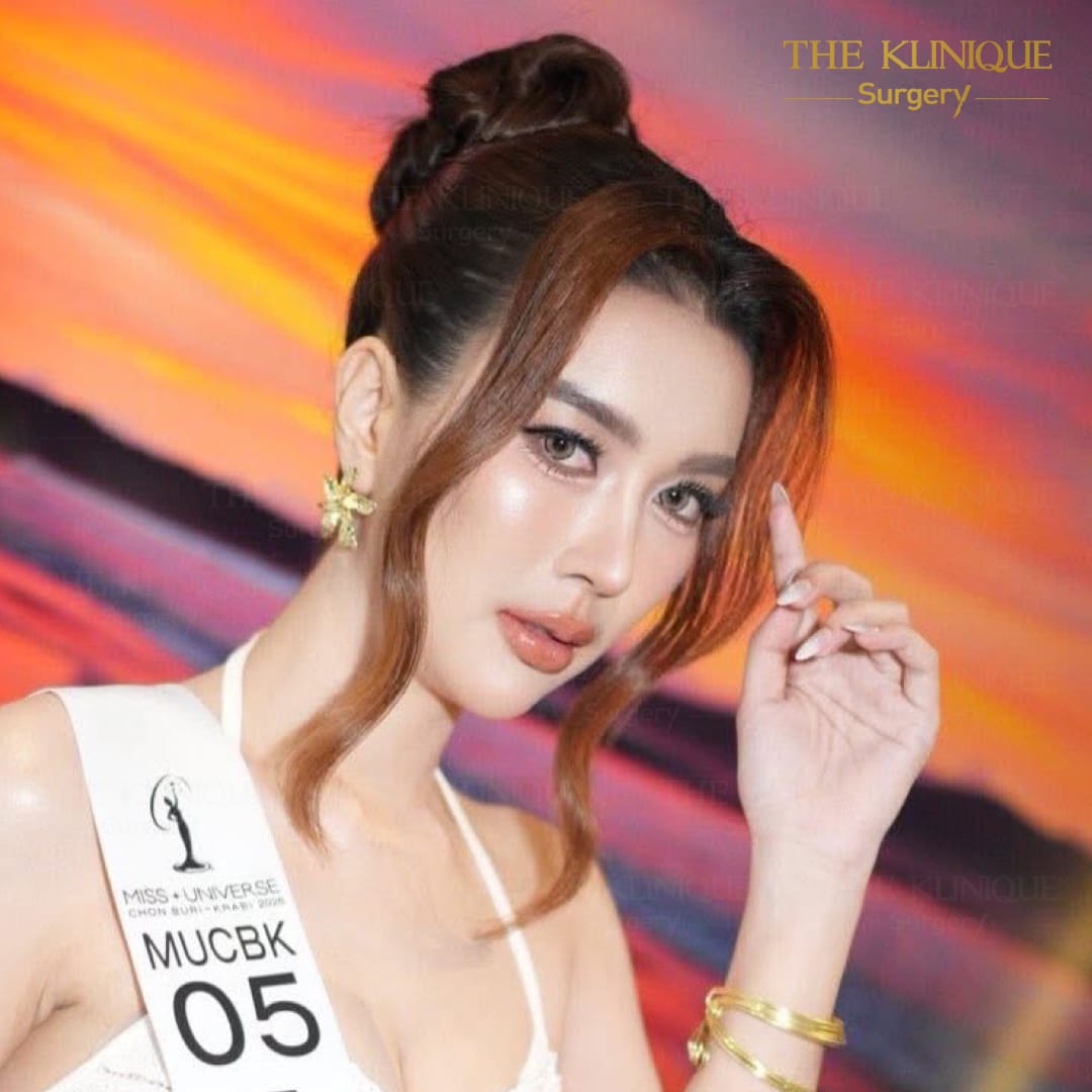 After เสริมจมูก semi
