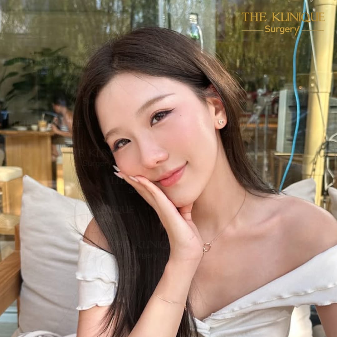 รีวิวเสริมจมูกsemi open