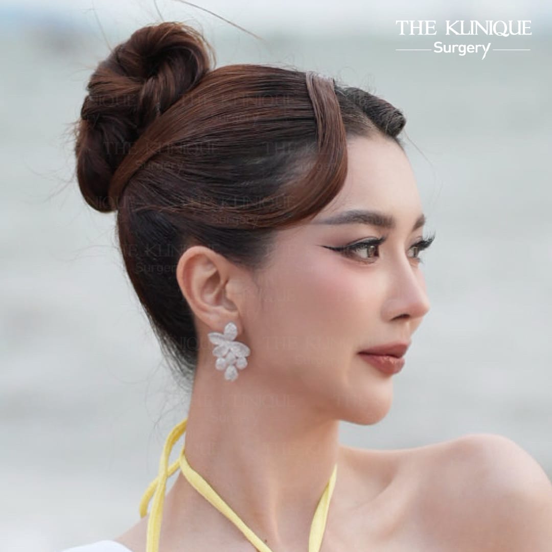 รีวิวเสริมจมูก Semi Open แพรพลอย MUT ชลบุรี