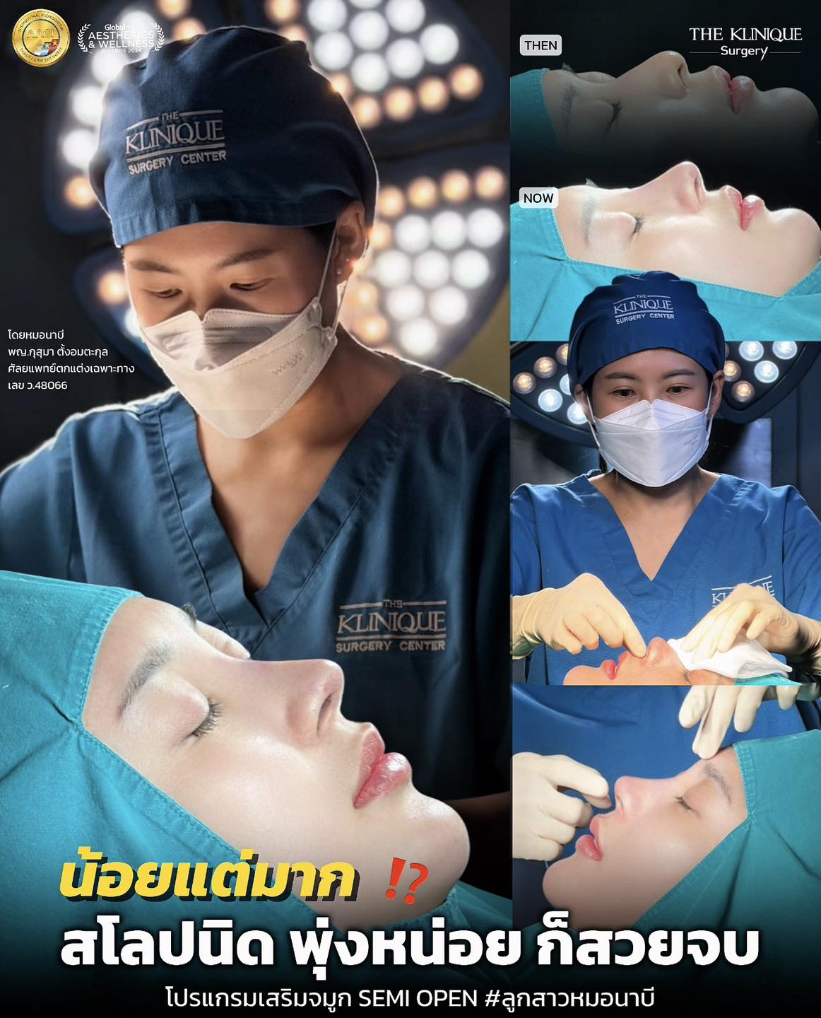 หมอนาบี แก้จมูก Semi Open