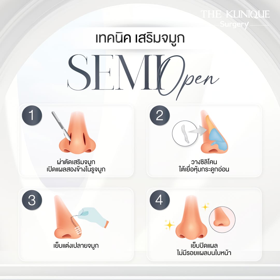เสริมจมูก Semi Open