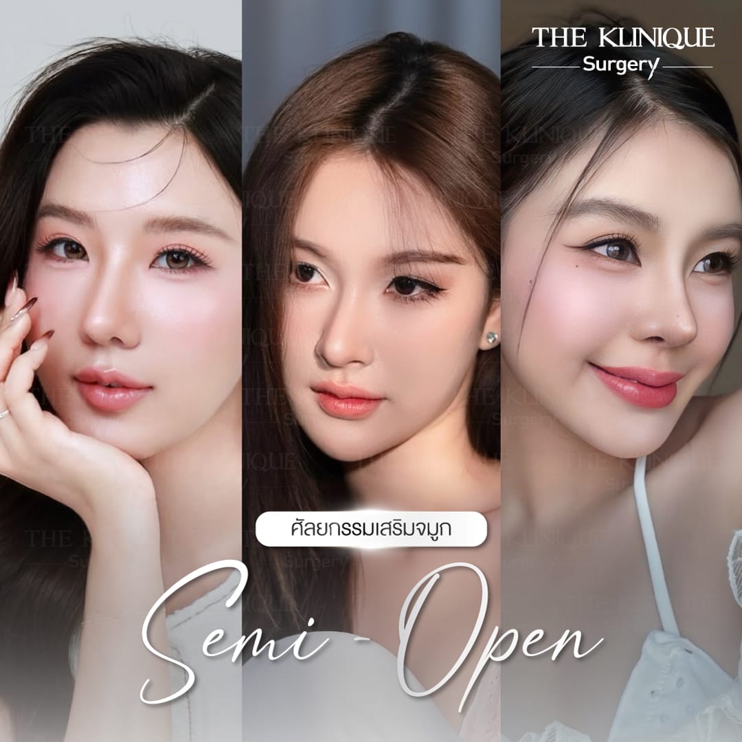 รีวิว เสริมจมูก Semi Opem