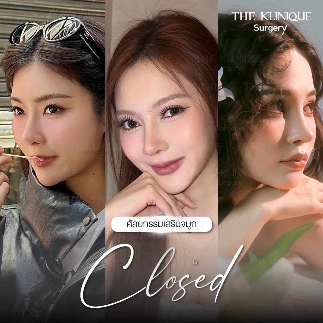 รีวิว เสริมจมูก Closed