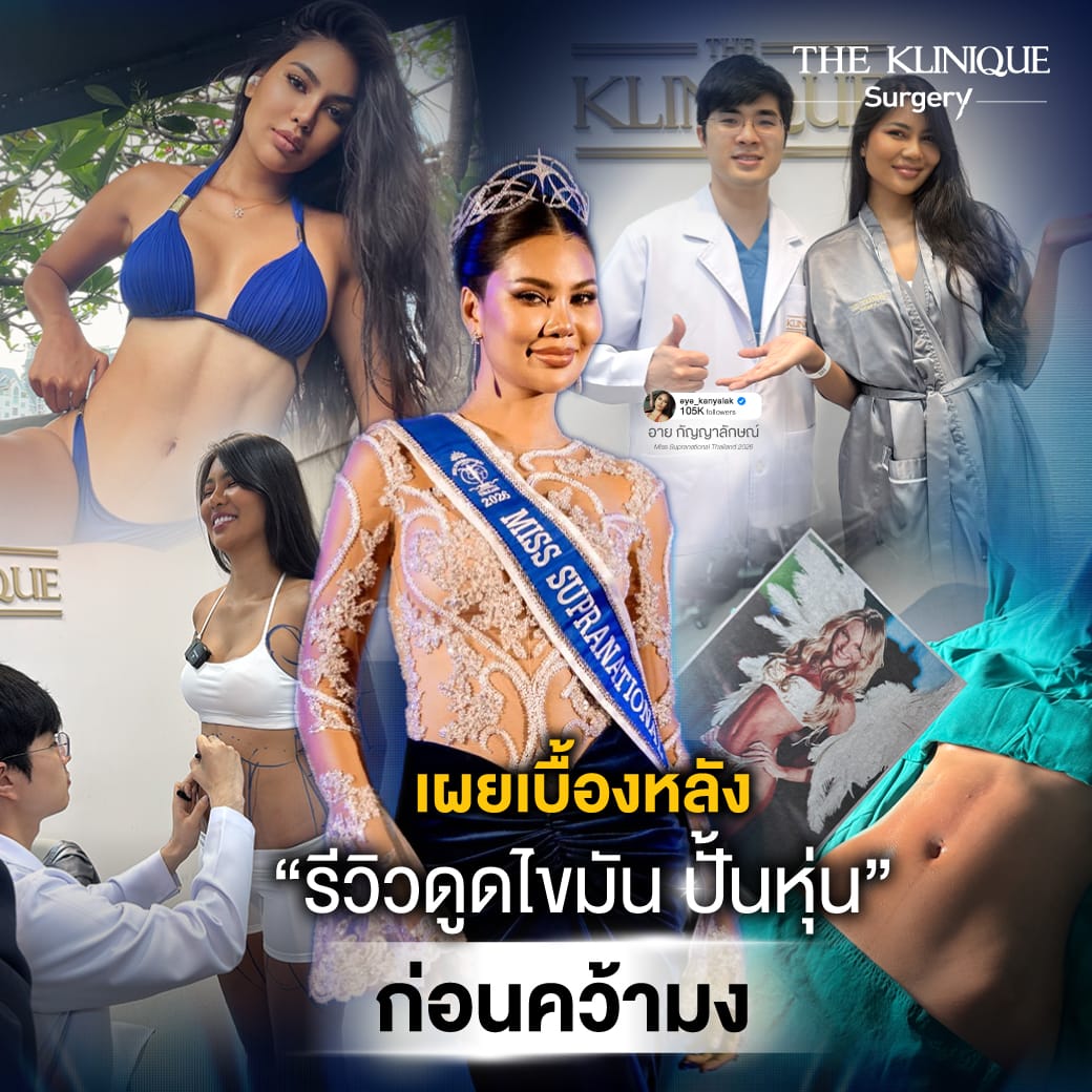 รีวิวดูดไขมันหน้าท้อง อาย