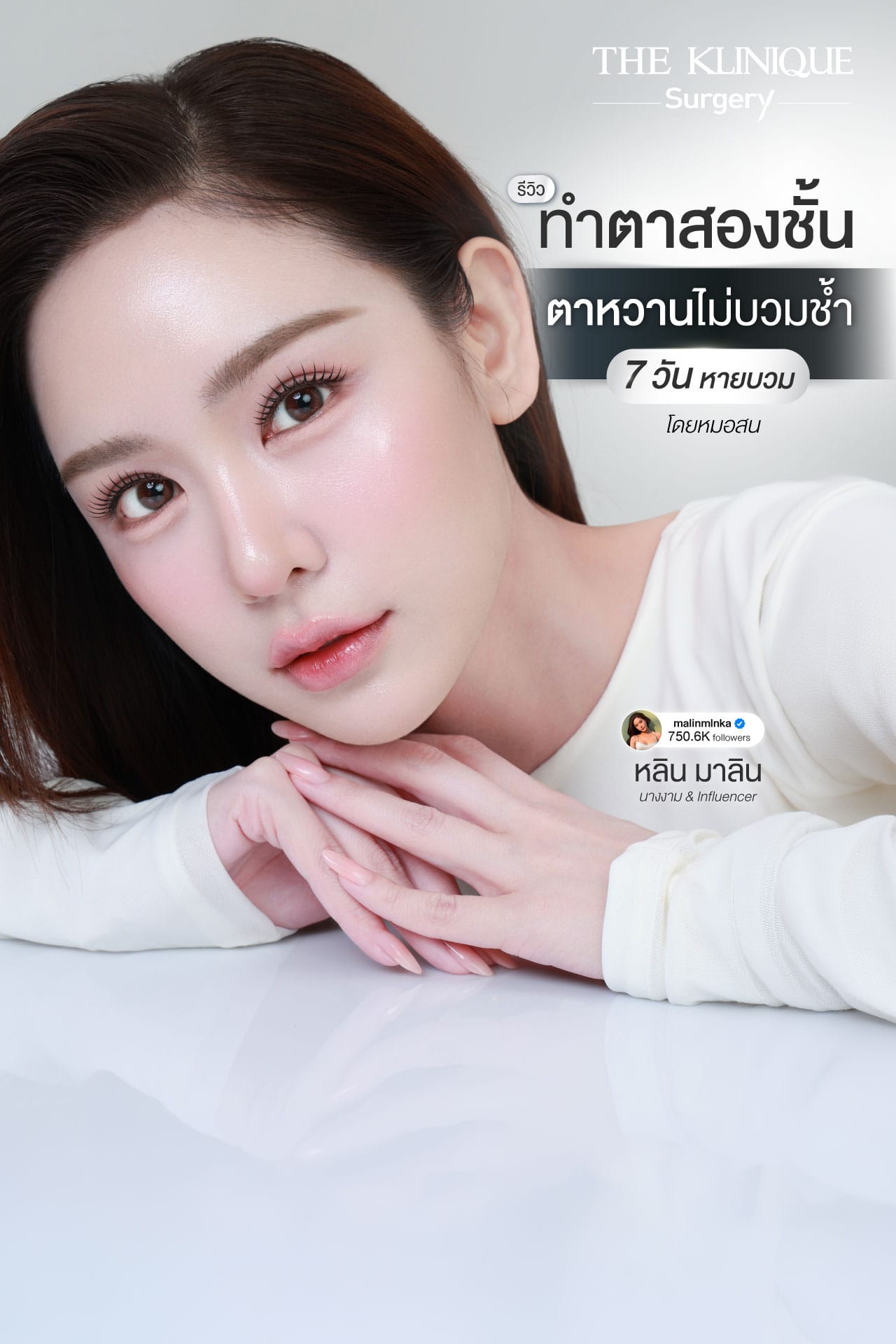 รีวิวทำตาสองชั้น Double Eyelid Surgery โดยหมอสน จักษุแพทย์