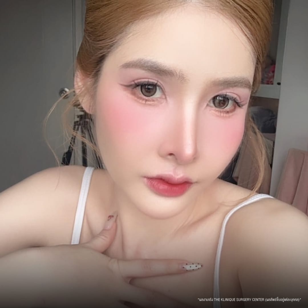 นุ่น ทำตาสองชั้น