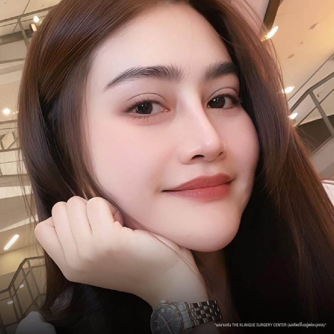 รีวิว ทำตาสองชั้น