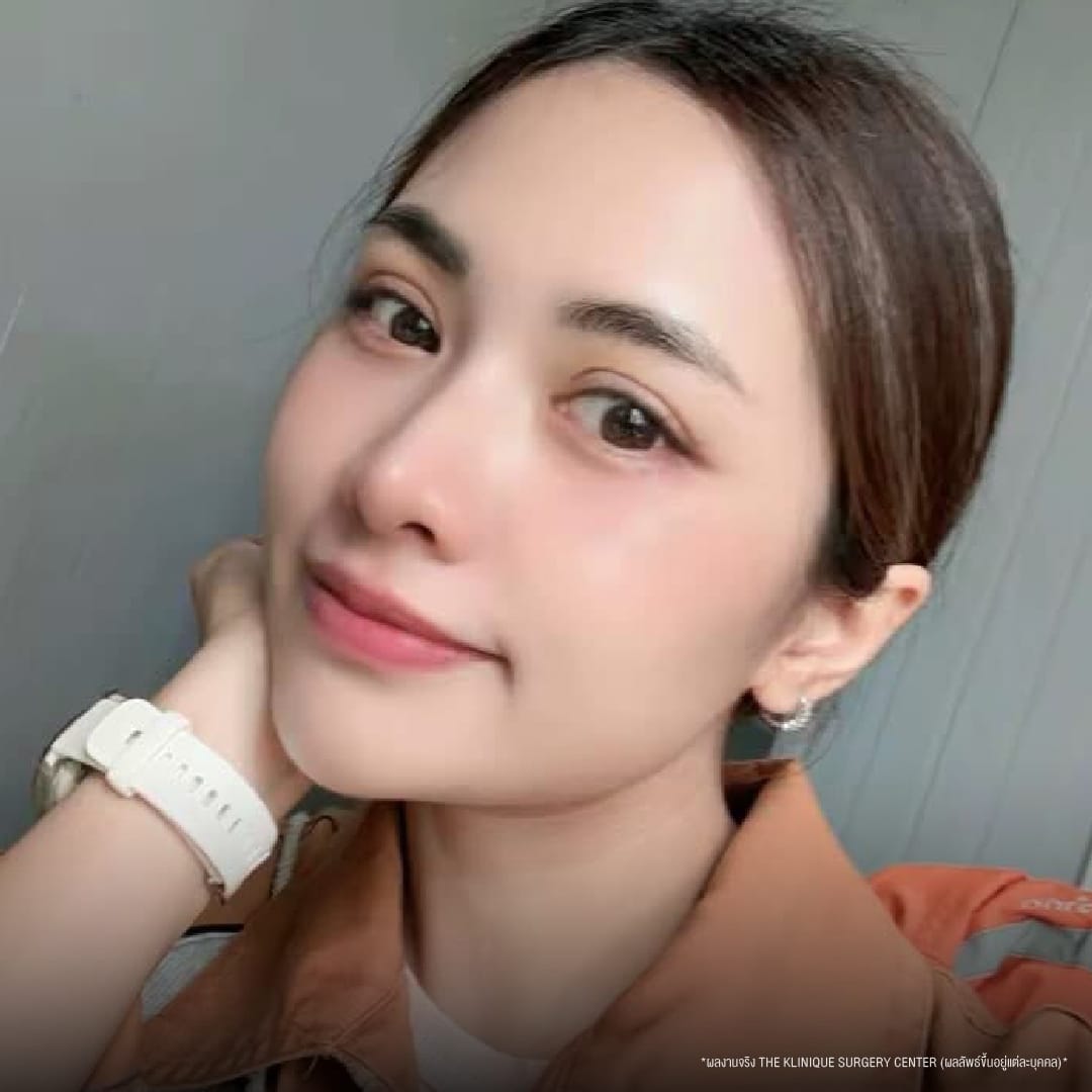 นุ่น รีวิวตาสองชั้น
