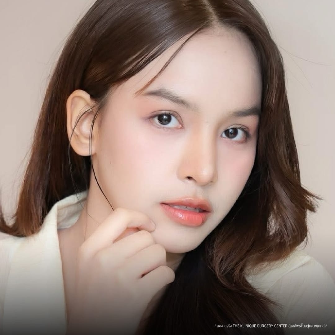 ทำตาสองชั้นรีวิว