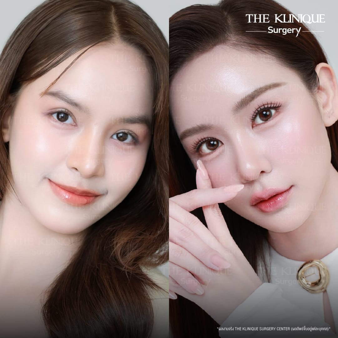 รีวิวทำตาสองชั้น