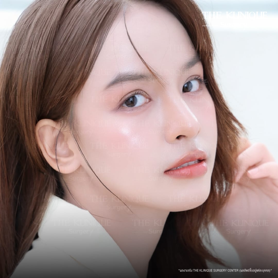 รีวิวทำตาสองชั้น