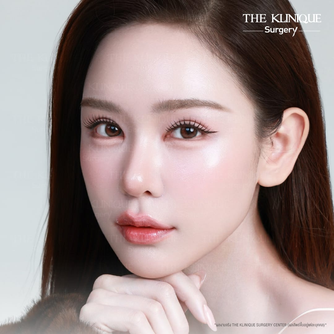 รีวิวทำตาสองชั้น 7 วัน