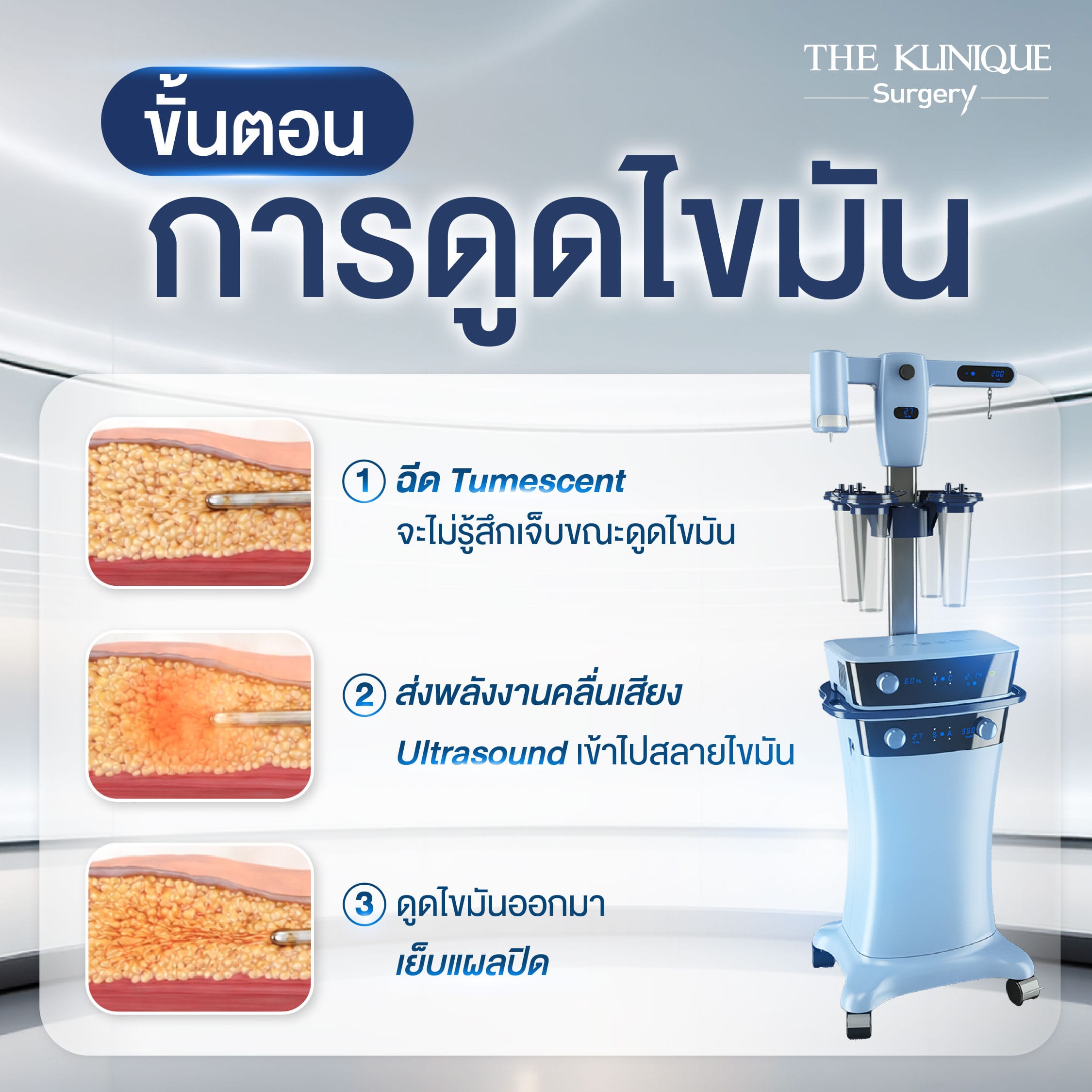 ขั้นตอนดูดไขมัน