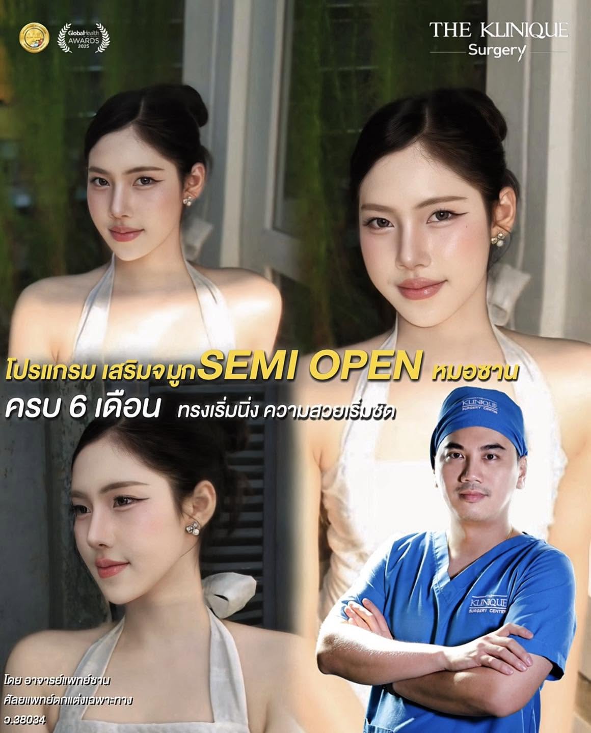 รีวิวเสริมจมูก Semi Open หมอซาน